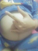 ใครเป็นธาลัสซีเมียแต่ท้องโตแล้วบ้าง