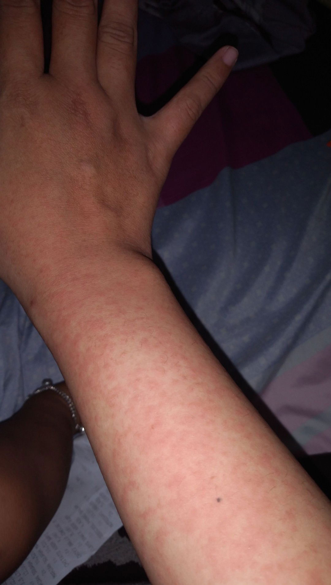 merah-merah di tambah gatal