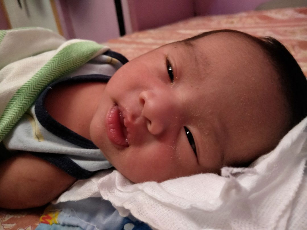 cut ng dila dahil maiksi daw dila ng lo ko. please enlighten me