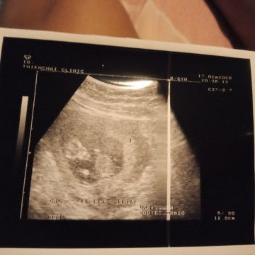 รูปน้อง