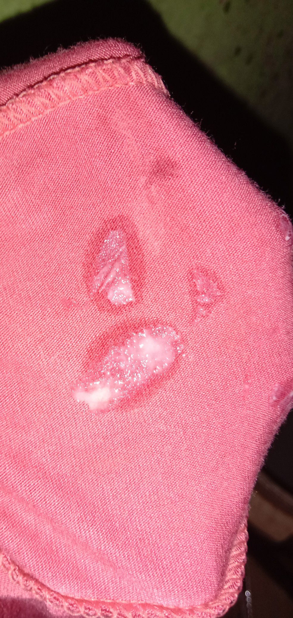 bunda maf jorok ,,bunda tolong. info ya dong ko kya gnih keputihan atau apa sih,,,soal kmren wktu tgl 2 udh kluar lendir coklat pagi,siang ya kluar lendir campur darah tpi dede ya masih ateng aj@