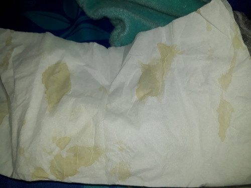keluar cairan dr vagina usia kehamilan 6 minggu