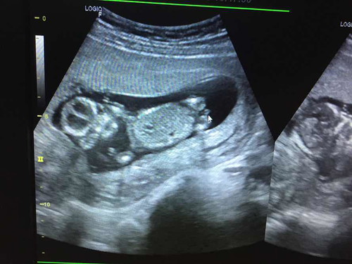 ชายหรือหญิง ค่ะ