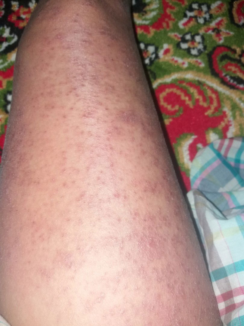 bawaan bayi atau penyakit lain