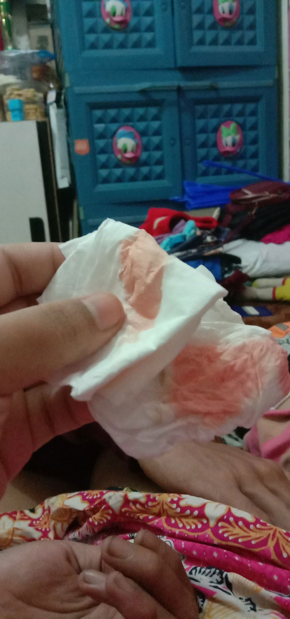 pendarahan usia 30weeks