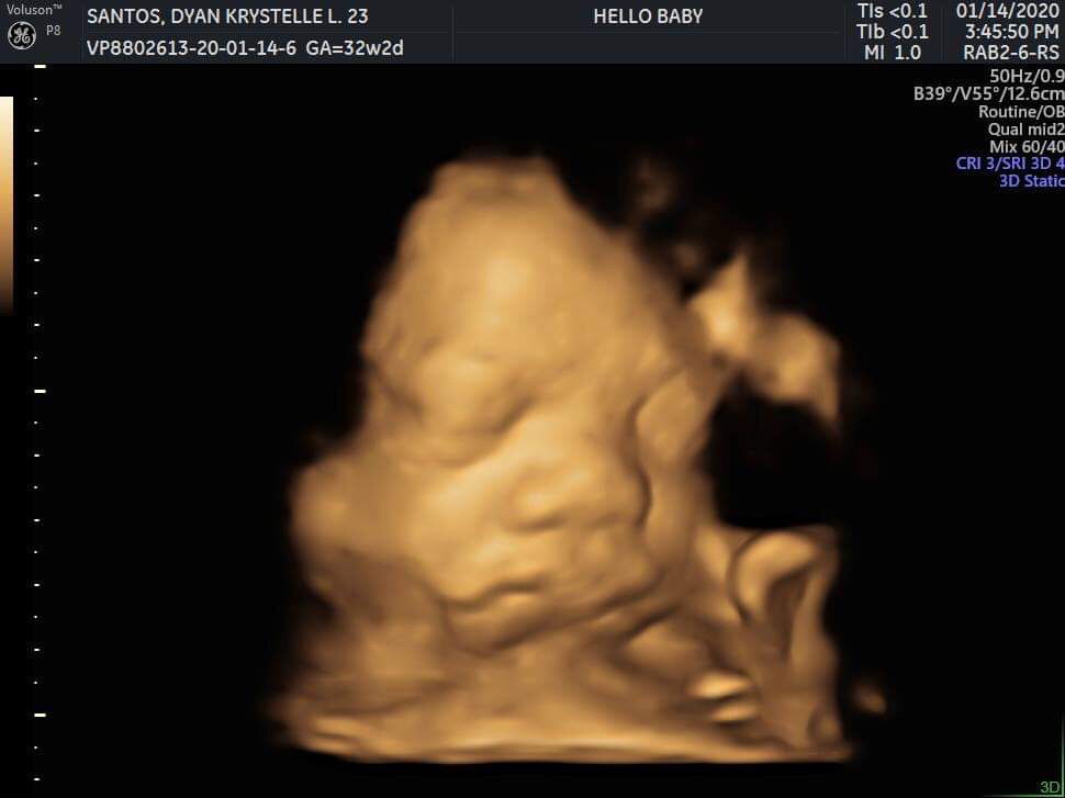 Dyan Lorenzo profile icon