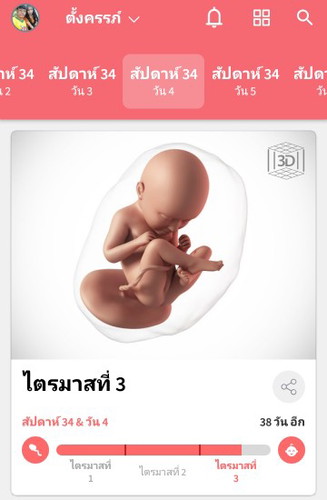 ปวดท้องคลอดเป็นยังไง