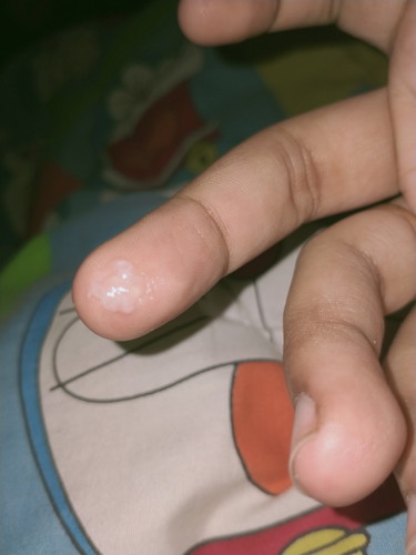 #ท้องแรก 38w3d *เรียกมูกใช่มั้ย