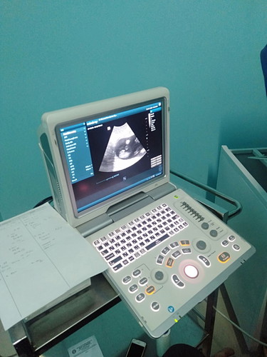 mau tanya bener ga ini tanda bayi laki laki