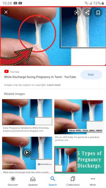 White discharge 5mos turning to 6mos next month
