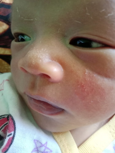 Kulit Bayi