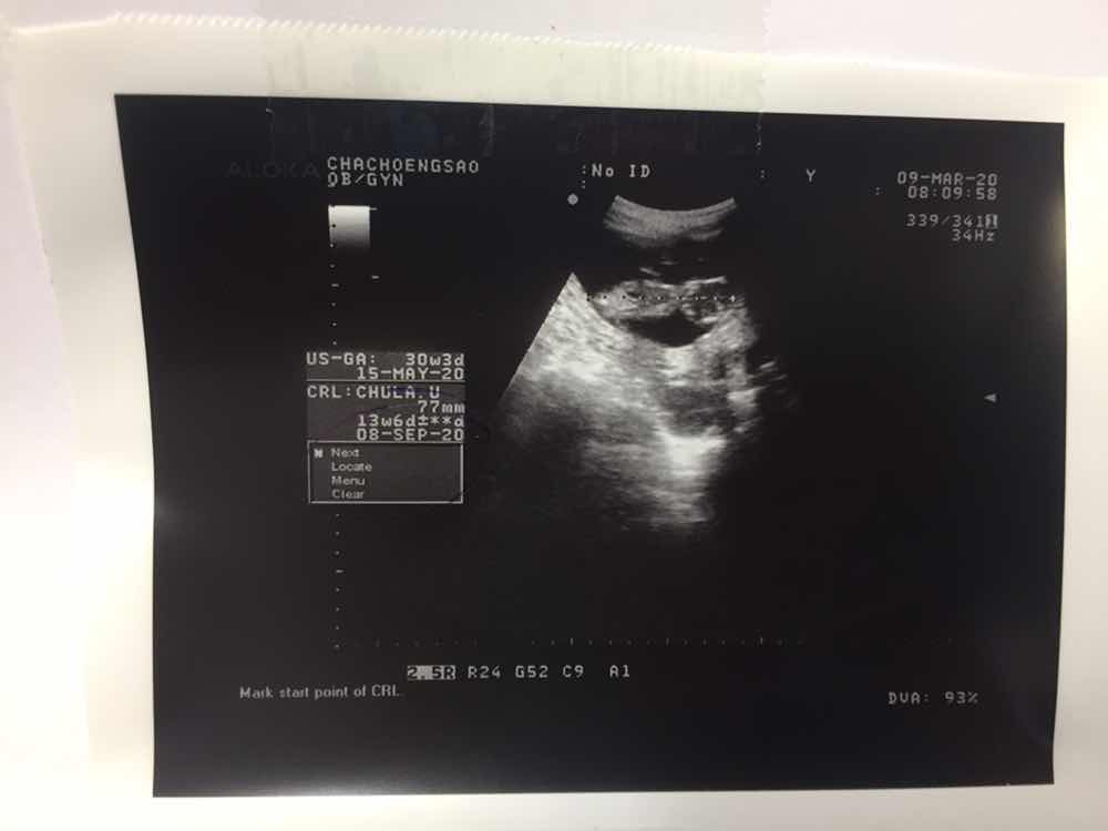 ศรัญญาพร ขำจิตร profile icon