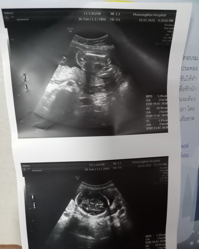 ลุ้นเพศ