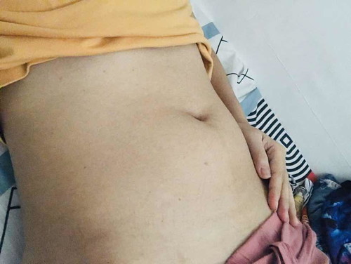 Baby Bump