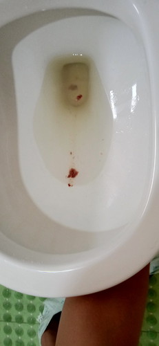 blood