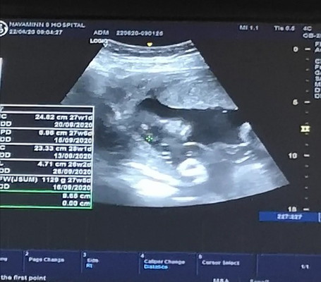 ลูกหมู27week