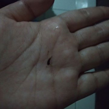 Adakah yg pernah alami keluar flek coklat di usia TM 2??