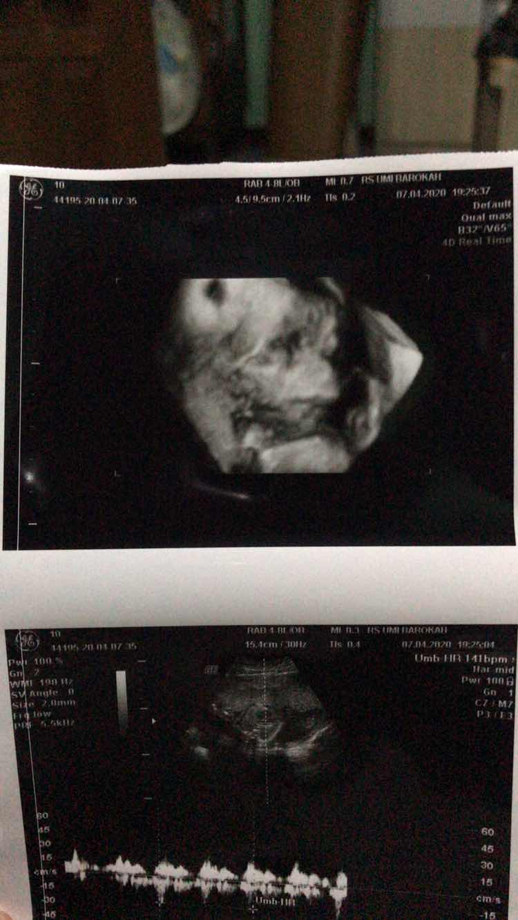 Okta Indah profile icon