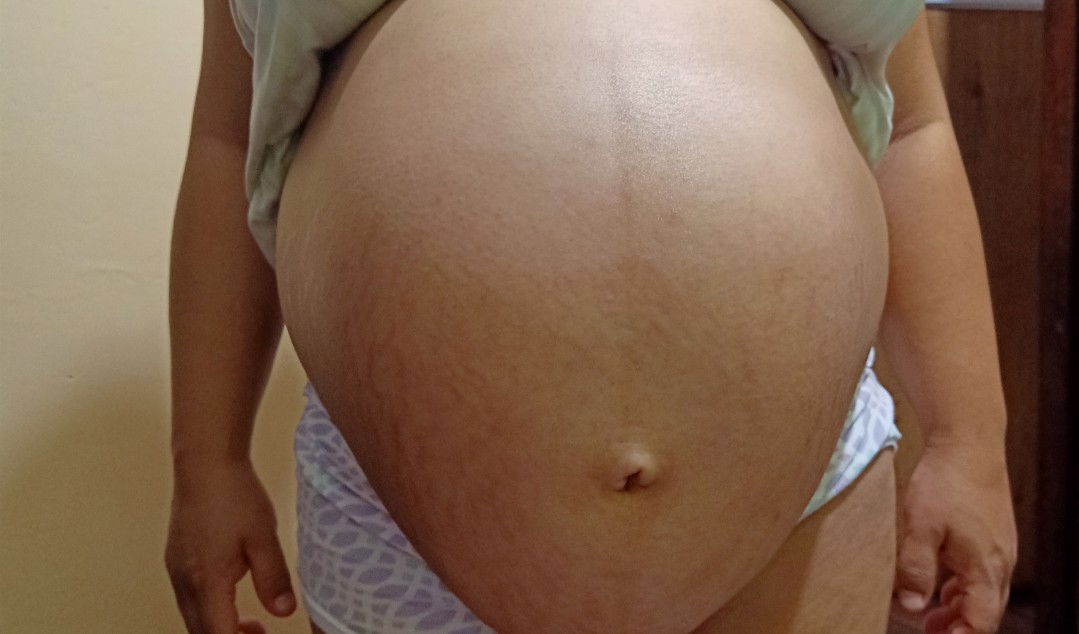 39 weeks and still close cervix