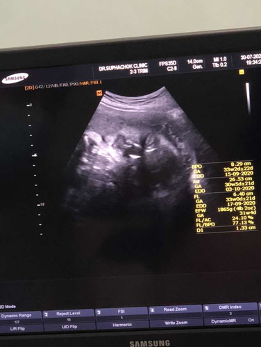 น้ำคร่ำน้อย มีวิธีดูแลตัวเองและลูกยังไงบ้างคะ