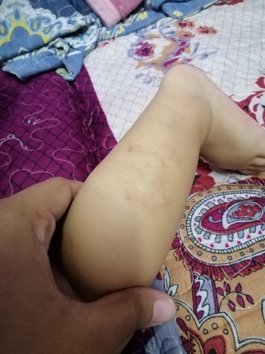 Mohon pertolongan Mommies