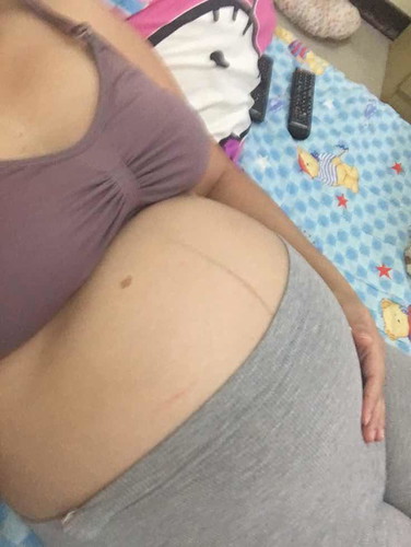 30+1w