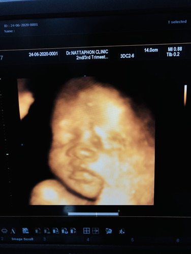 มาแว้ววววว