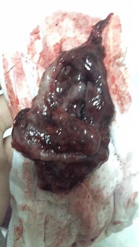 ใครมีก้อนเลือดออกมาตอนท้องบ้างค่ะ? ถ้ามีคอมเม้นกันหน่อยนะคะ