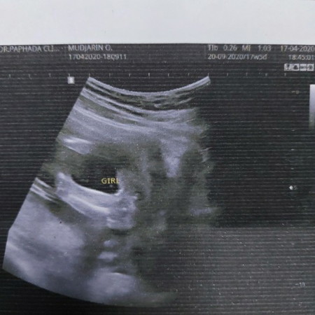 กังวลปัญหาเรื่องจักแร้ดำคล้ำ