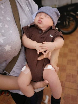 After Vaccine Care