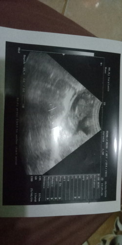 bayiku umur 17minggu