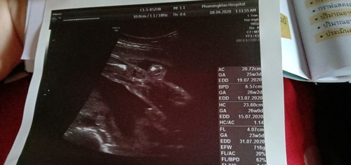 สอบถามหน่อยค่ะ