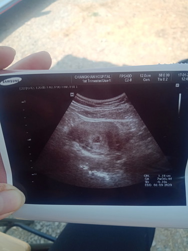 8w1d แล้วค่ะคุณหมอวัดผิด