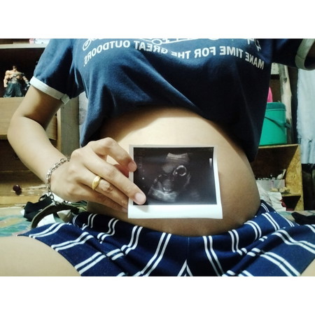 กำหนดคลอด12สิงหา