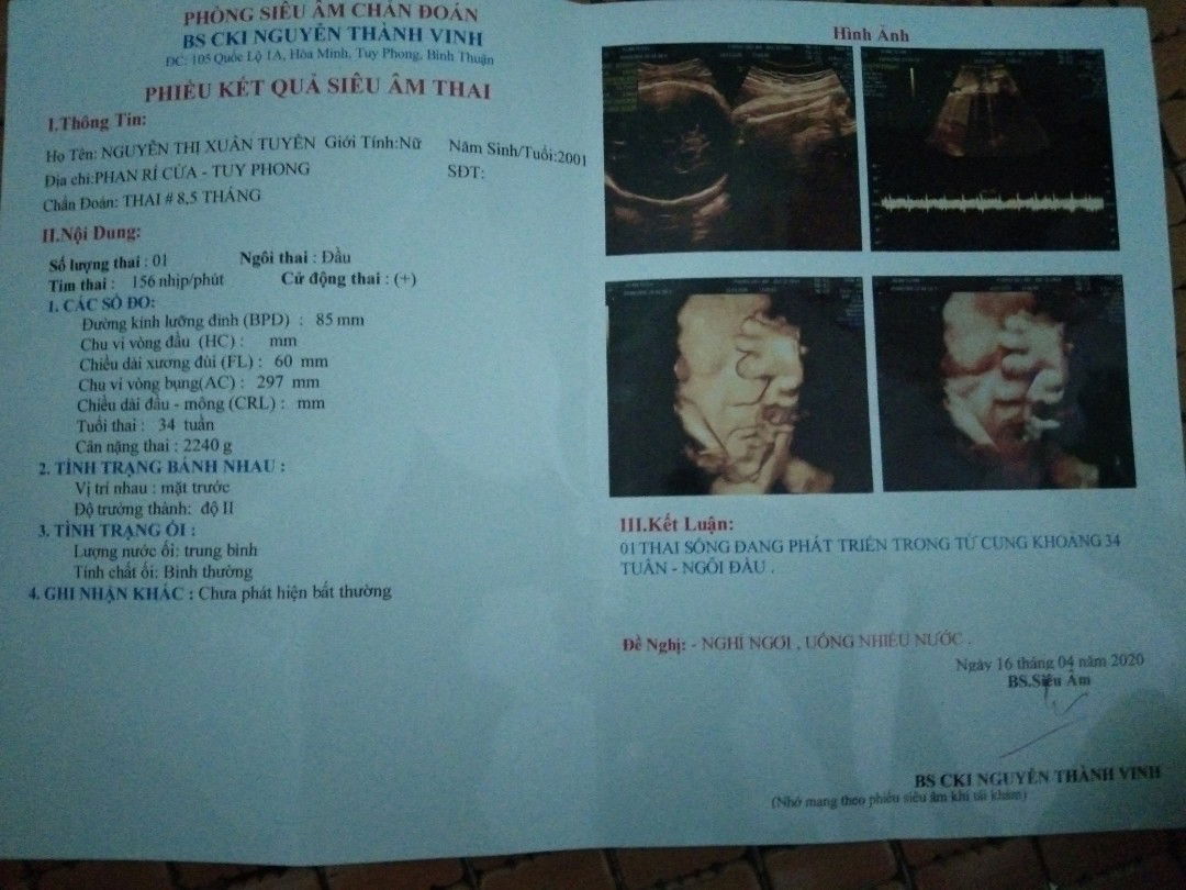 chuột trai nhà em