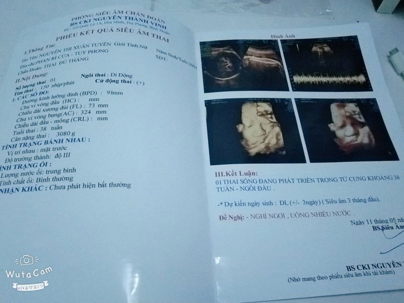 mong cơn đau đẻ