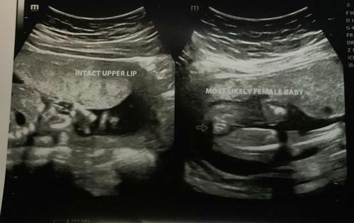 Baby girl or possible boy?
