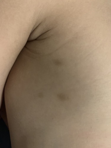 What do u think these 3 dots are?