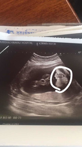 อยากทราบเพศลูก??