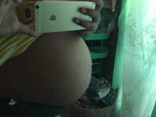 36 w แล้วมีความตื่นเต้น แม่แม่ท่านไหนทีมมีนาบ้างค่ะ