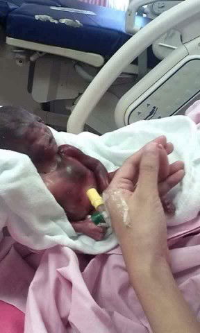 Pentingnya Kelola Stres Saat Hamil