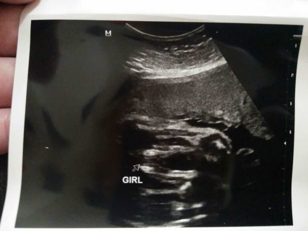 baby girl atau baby boy