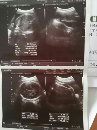 ULTRASOUND RESULT