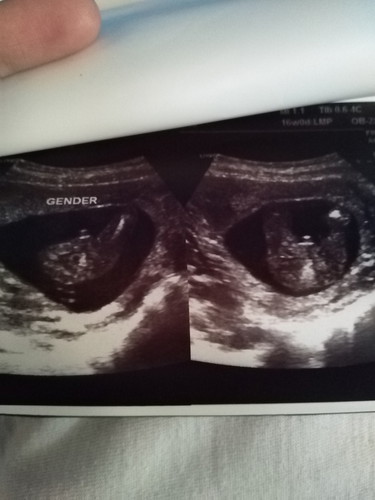 Notice Me! Male Na Po Ba Talaga Ito?