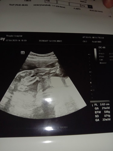 หญิงรึชาย