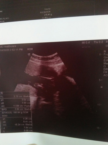 ลองเดาหน่อยค่ะ