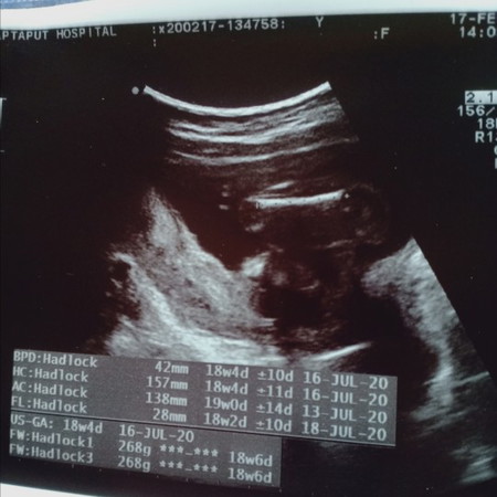 แบบนี้ชายหรือหญิง