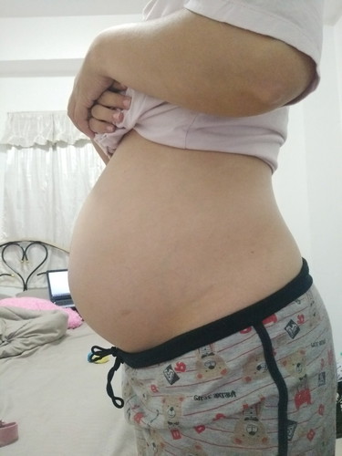 25 Week แล้ว ยังไม่รู้เพศลูกเลย