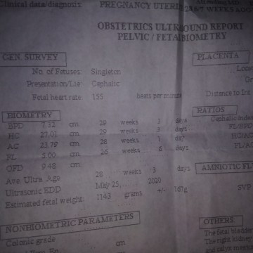 biometry..