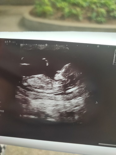 girl or boy